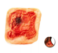 Falsa cicatrice rossastra adulta