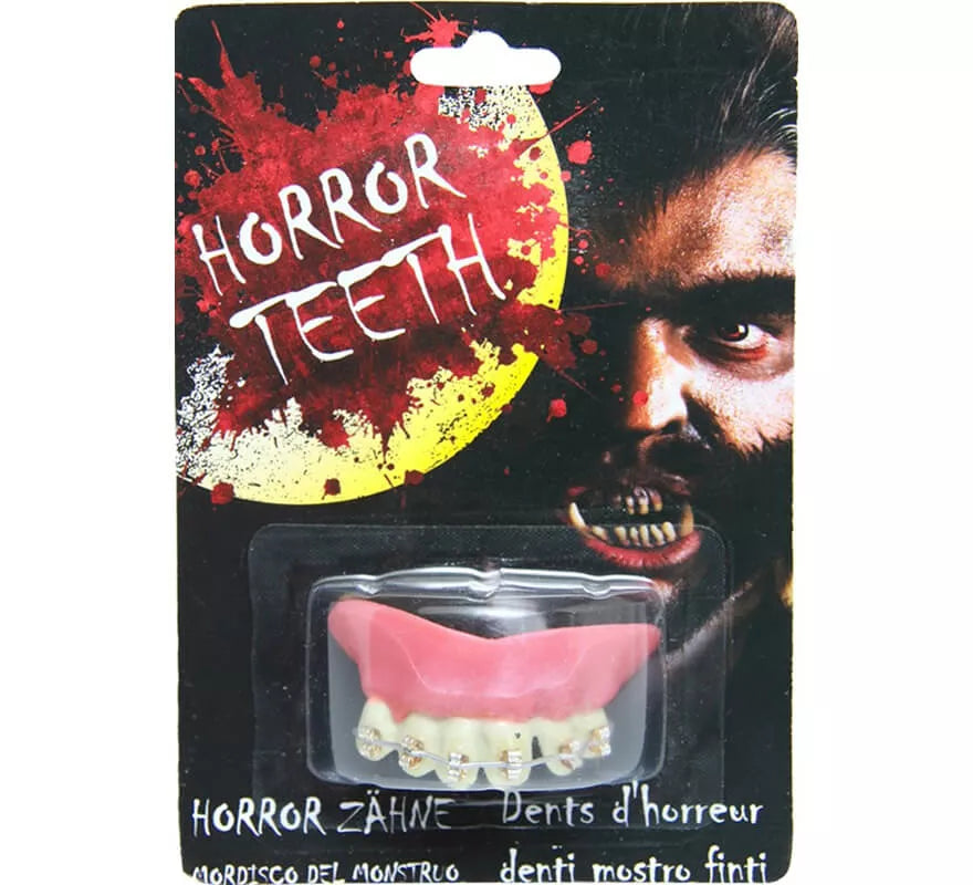 Translation missing: it.Dentadura con Brakets