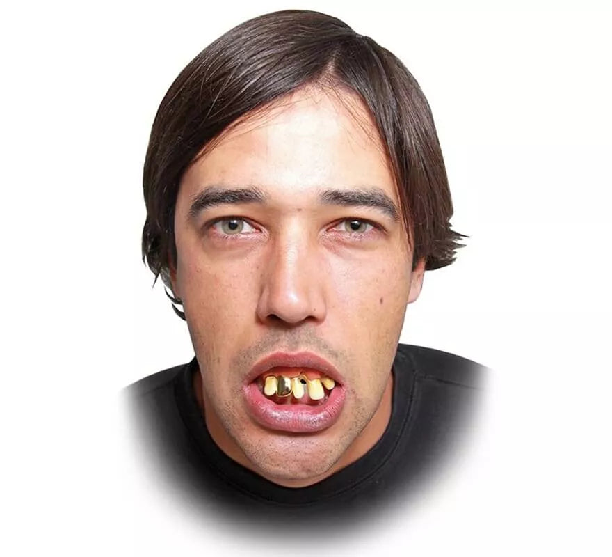 Dentadura con diente de oro