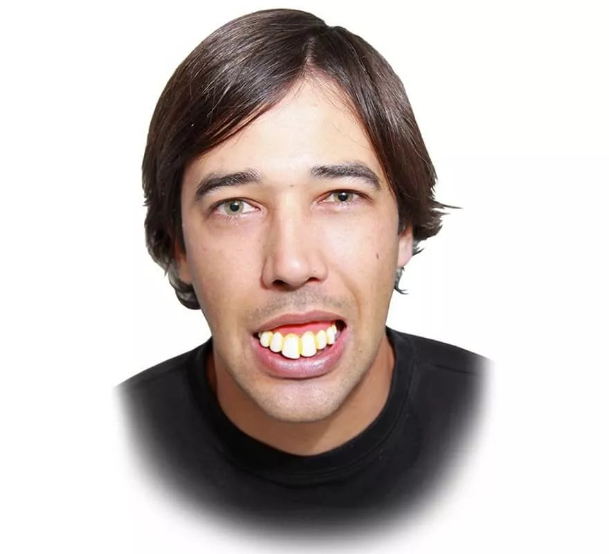 Translation missing: it.Dentadura con dientes extra grande