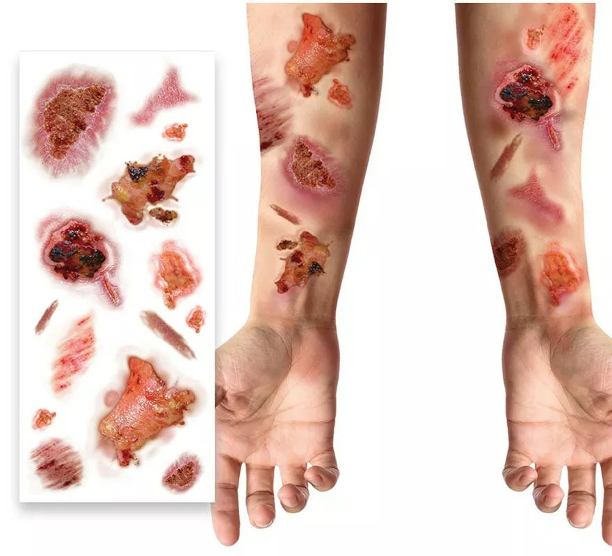 Translation missing: es.Tatuajes con Heridas Infectadas